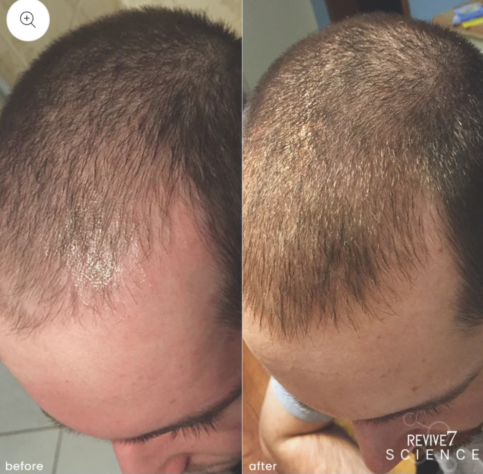 Revive7 Hair Treatment