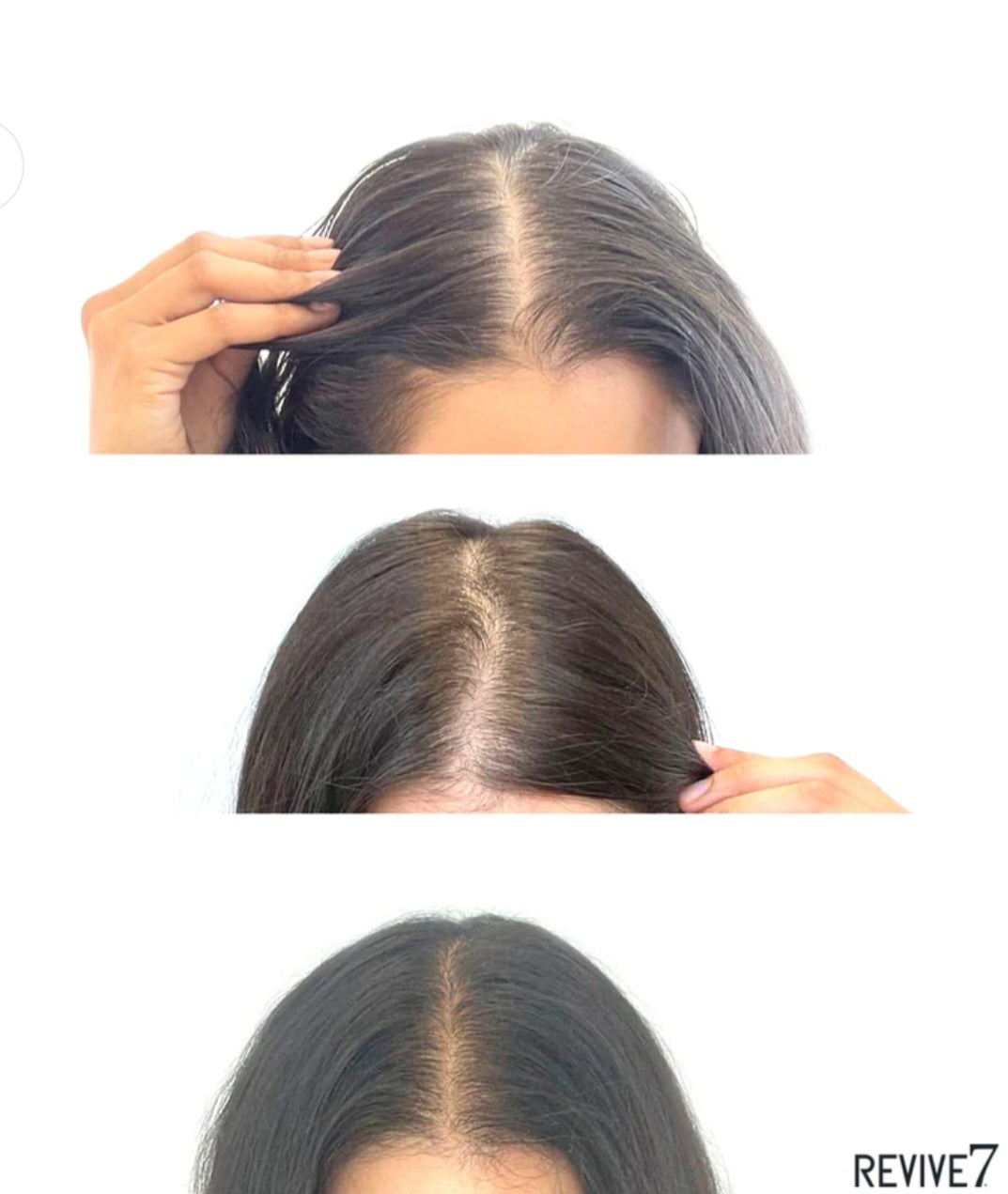 Revive7 Hair Treatment